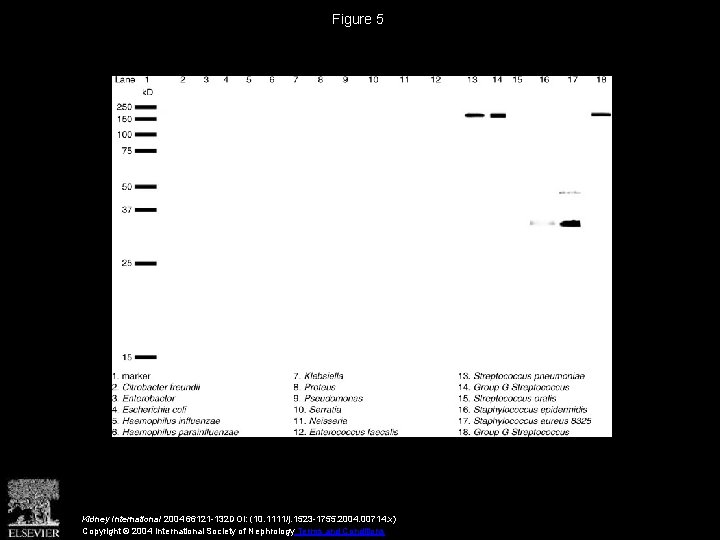 Figure 5 Kidney International 2004 66121 -132 DOI: (10. 1111/j. 1523 -1755. 2004. 00714.