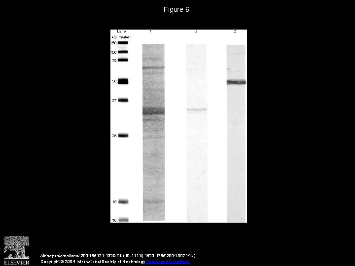 Figure 6 Kidney International 2004 66121 -132 DOI: (10. 1111/j. 1523 -1755. 2004. 00714.