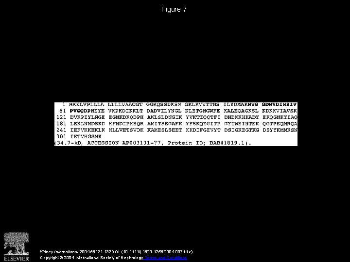 Figure 7 Kidney International 2004 66121 -132 DOI: (10. 1111/j. 1523 -1755. 2004. 00714.