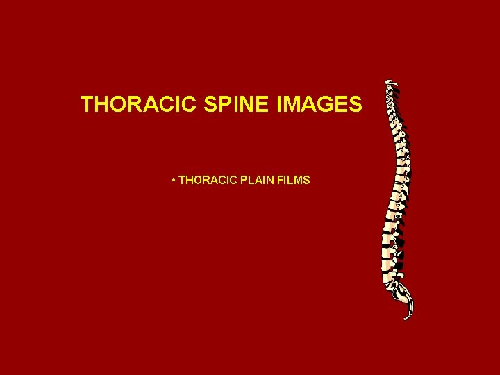 THORACIC SPINE IMAGES • THORACIC PLAIN FILMS 