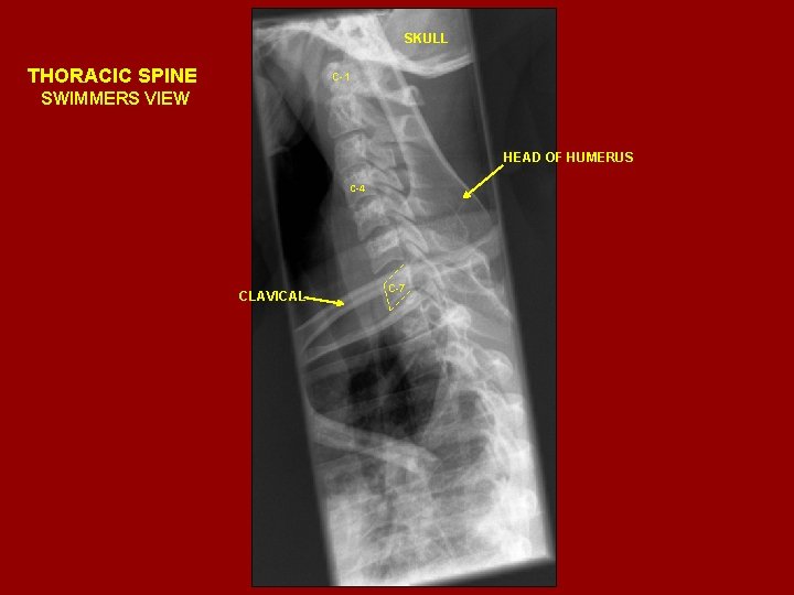 SKULL THORACIC SPINE C-1 SWIMMERS VIEW HEAD OF HUMERUS C-4 CLAVICAL C-7 