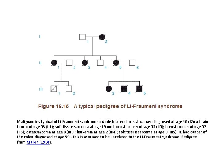 Malignancies typical of Li-Fraumeni syndrome include bilateral breast cancer diagnosed at age 40 (I