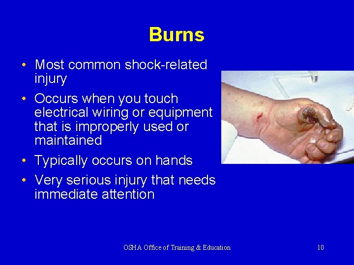 Burns • Most common shock-related injury • Occurs when you touch electrical wiring or