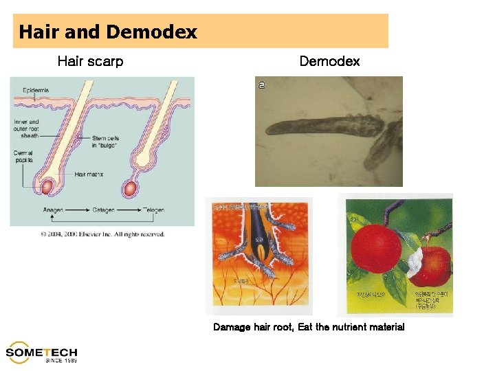 Hair and Demodex Hair scarp Demodex Damage hair root, Eat the nutrient material 