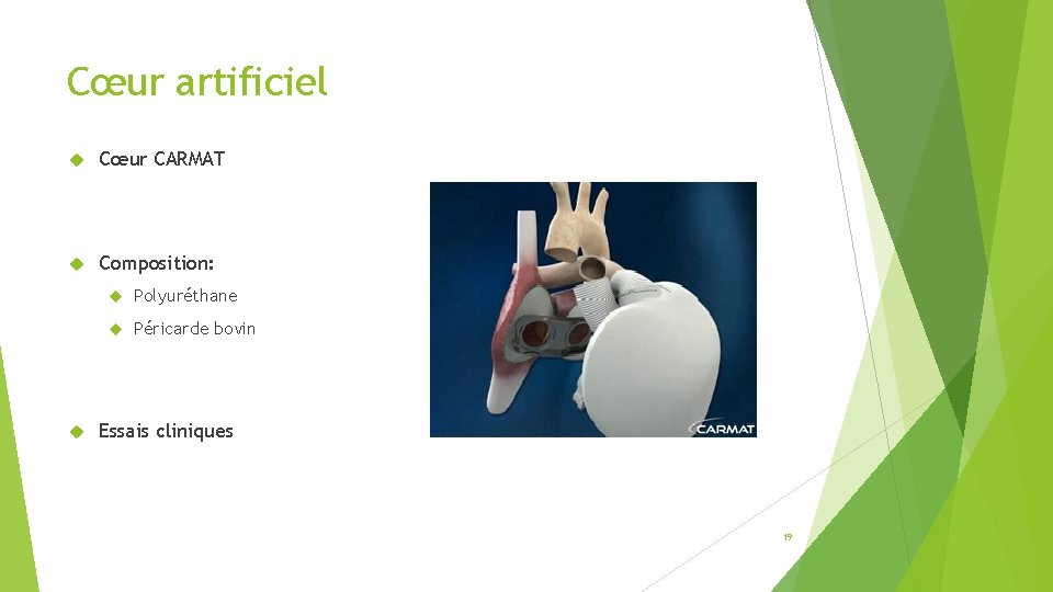 Cœur artificiel Cœur CARMAT Composition: Polyuréthane Péricarde bovin Essais cliniques 19 