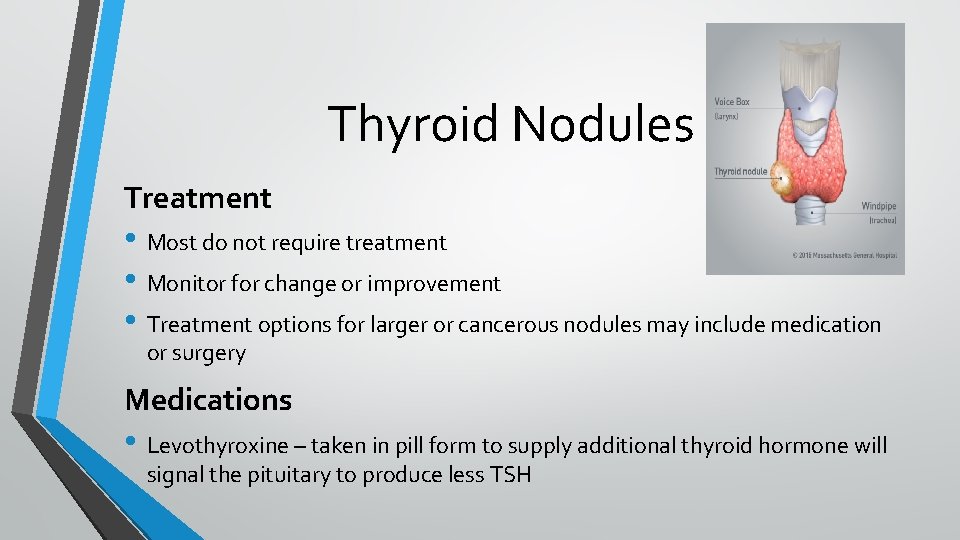 Thyroid Nodules Treatment • Most do not require treatment • Monitor for change or