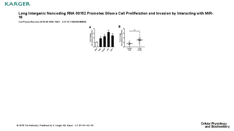 Long Intergenic Noncoding RNA 00152 Promotes Glioma Cell Proliferation and Invasion by Interacting with