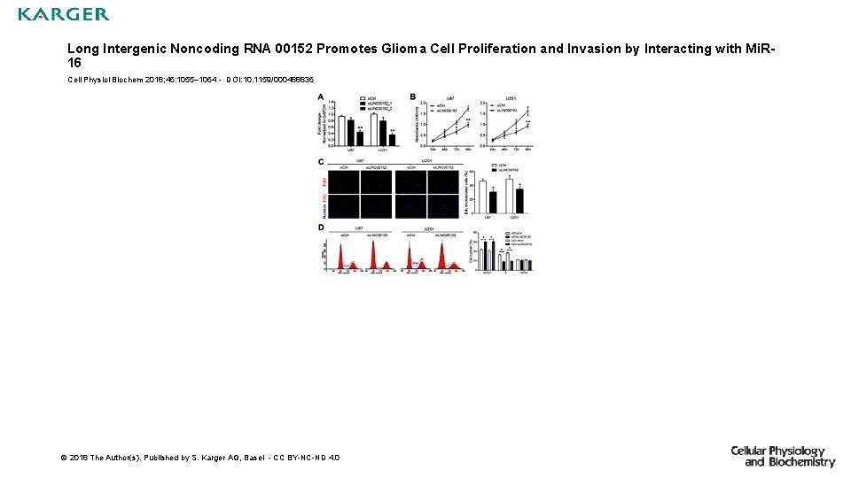 Long Intergenic Noncoding RNA 00152 Promotes Glioma Cell Proliferation and Invasion by Interacting with