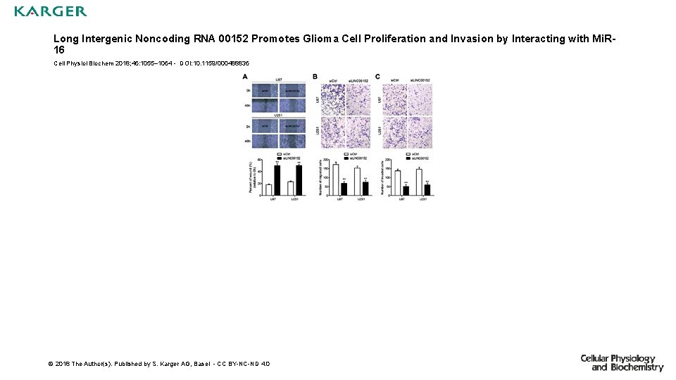 Long Intergenic Noncoding RNA 00152 Promotes Glioma Cell Proliferation and Invasion by Interacting with