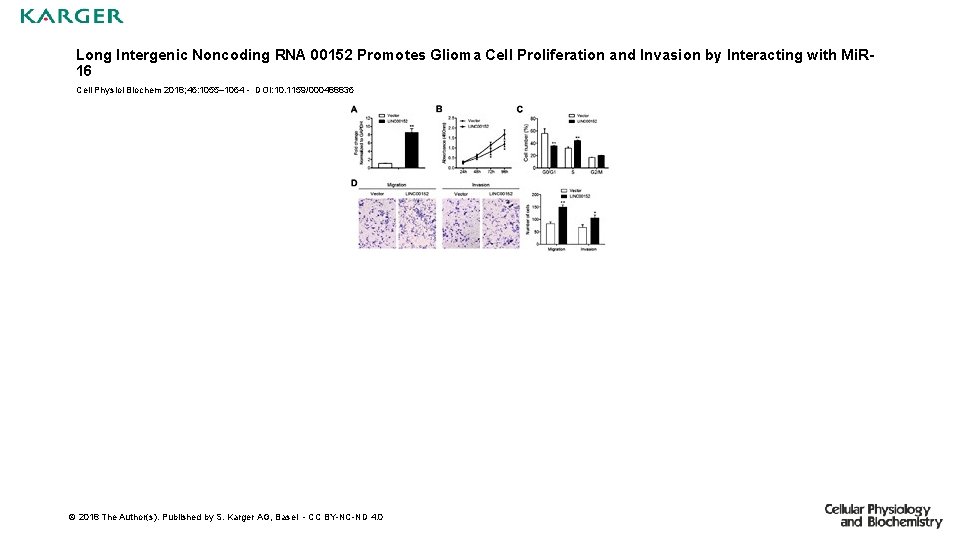 Long Intergenic Noncoding RNA 00152 Promotes Glioma Cell Proliferation and Invasion by Interacting with