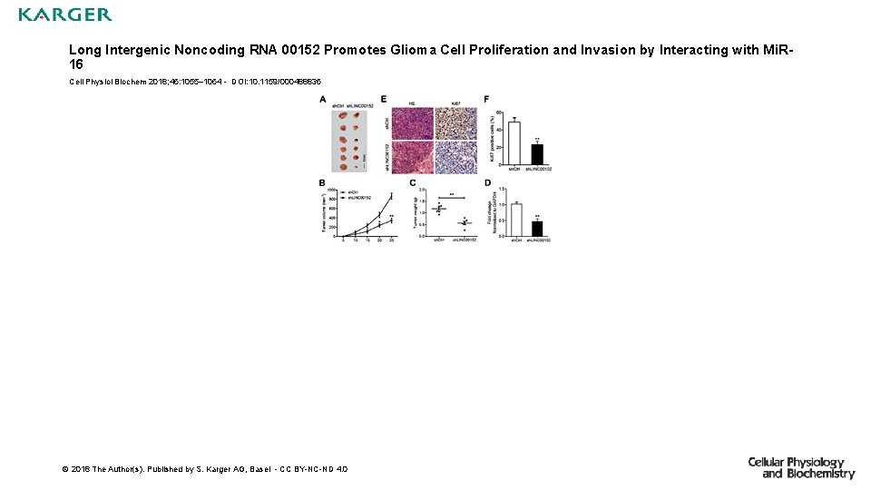 Long Intergenic Noncoding RNA 00152 Promotes Glioma Cell Proliferation and Invasion by Interacting with