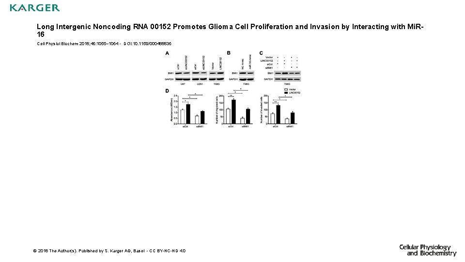 Long Intergenic Noncoding RNA 00152 Promotes Glioma Cell Proliferation and Invasion by Interacting with