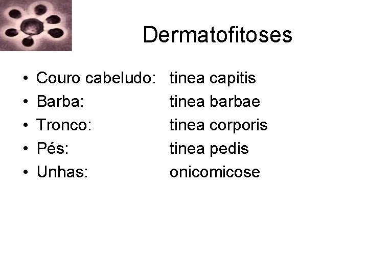 Dermatofitoses • • • Couro cabeludo: Barba: Tronco: Pés: Unhas: tinea capitis tinea barbae Dermatofitoses • • • Couro cabeludo: Barba: Tronco: Pés: Unhas: tinea capitis tinea barbae
