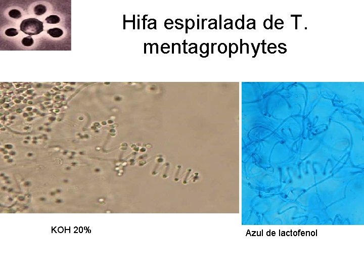 Hifa espiralada de T. mentagrophytes KOH 20% Azul de lactofenol Hifa espiralada de T. mentagrophytes KOH 20% Azul de lactofenol