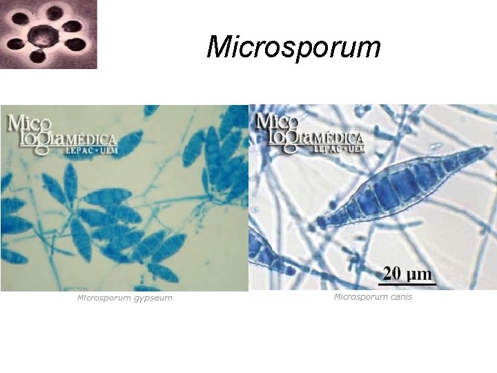 Microsporum Microsporum