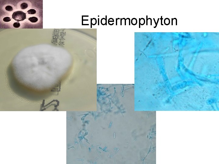 Epidermophyton Epidermophyton