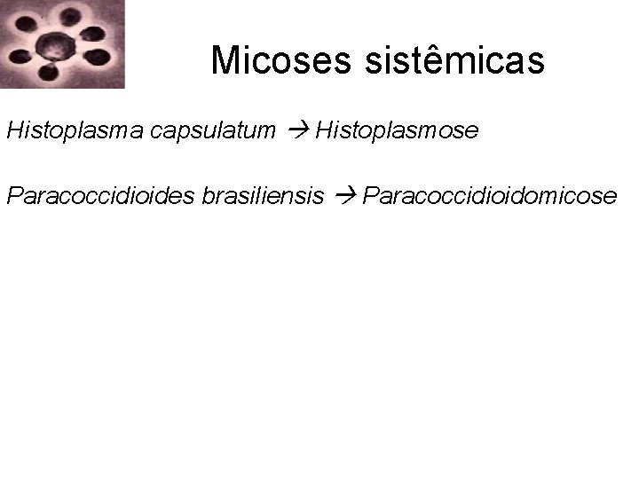 Micoses sistêmicas Histoplasma capsulatum Histoplasmose Paracoccidioides brasiliensis Paracoccidioidomicose Micoses sistêmicas Histoplasma capsulatum Histoplasmose Paracoccidioides brasiliensis Paracoccidioidomicose