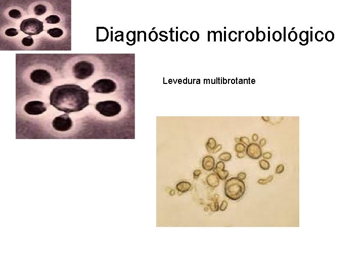 Diagnóstico microbiológico Levedura multibrotante Diagnóstico microbiológico Levedura multibrotante