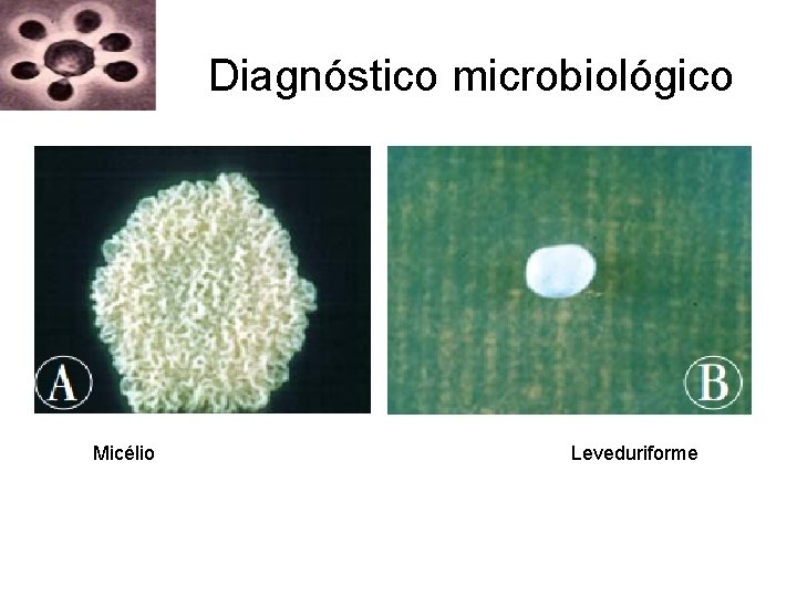 Diagnóstico microbiológico Micélio Leveduriforme Diagnóstico microbiológico Micélio Leveduriforme