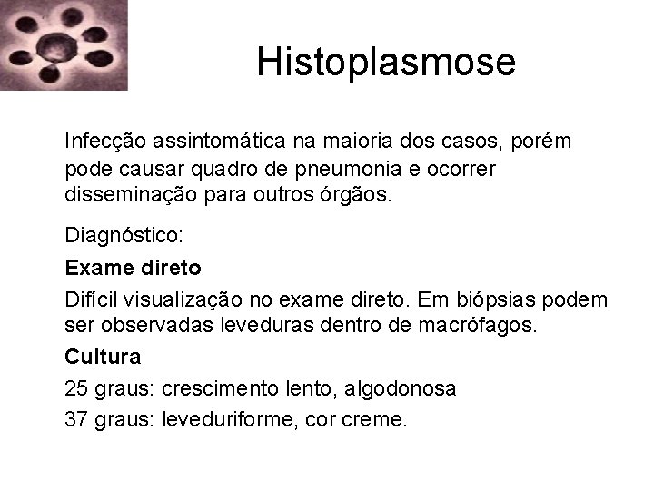 Histoplasmose Infecção assintomática na maioria dos casos, porém pode causar quadro de pneumonia e Histoplasmose Infecção assintomática na maioria dos casos, porém pode causar quadro de pneumonia e
