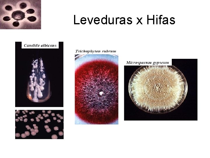 Leveduras x Hifas Leveduras x Hifas