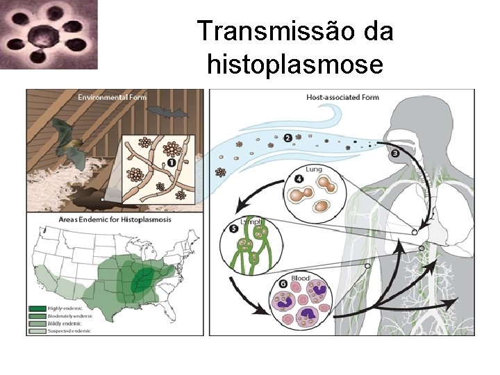 Transmissão da histoplasmose Transmissão da histoplasmose