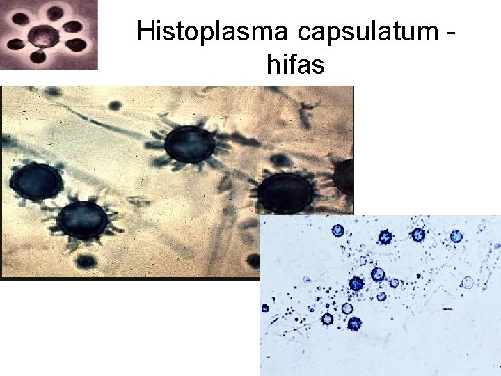 Histoplasma capsulatum hifas Histoplasma capsulatum hifas