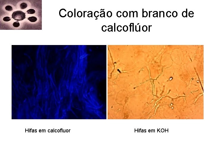 Coloração com branco de calcoflúor Hifas em calcofluor Hifas em KOH Coloração com branco de calcoflúor Hifas em calcofluor Hifas em KOH