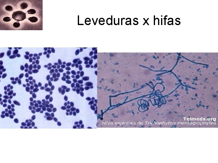 Leveduras x hifas Leveduras x hifas