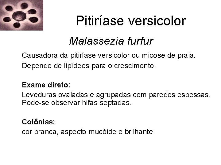 Pitiríase versicolor Malassezia furfur Causadora da pitiríase versicolor ou micose de praia. Depende de Pitiríase versicolor Malassezia furfur Causadora da pitiríase versicolor ou micose de praia. Depende de