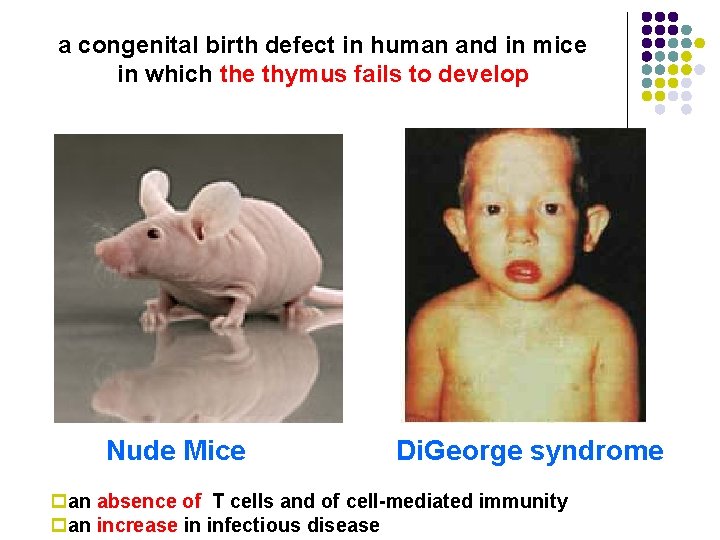 a congenital birth defect in human and in mice in which the thymus fails