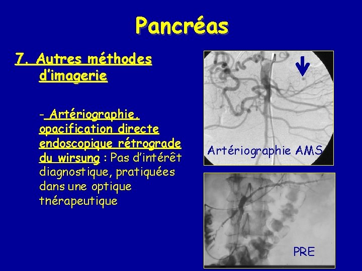 Pancréas 7. Autres méthodes d’imagerie - Artériographie, opacification directe endoscopique rétrograde du wirsung :