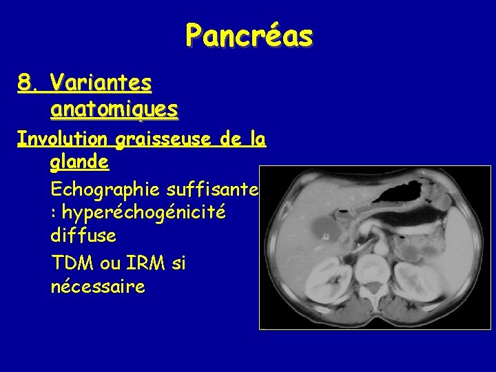 Pancréas 8. Variantes anatomiques Involution graisseuse de la glande Echographie suffisante : hyperéchogénicité diffuse