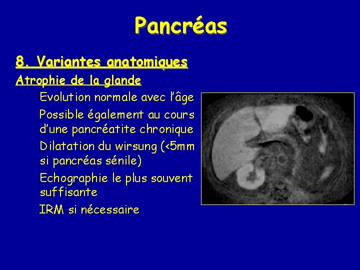 Pancréas 8. Variantes anatomiques Atrophie de la glande Evolution normale avec l’âge Possible également