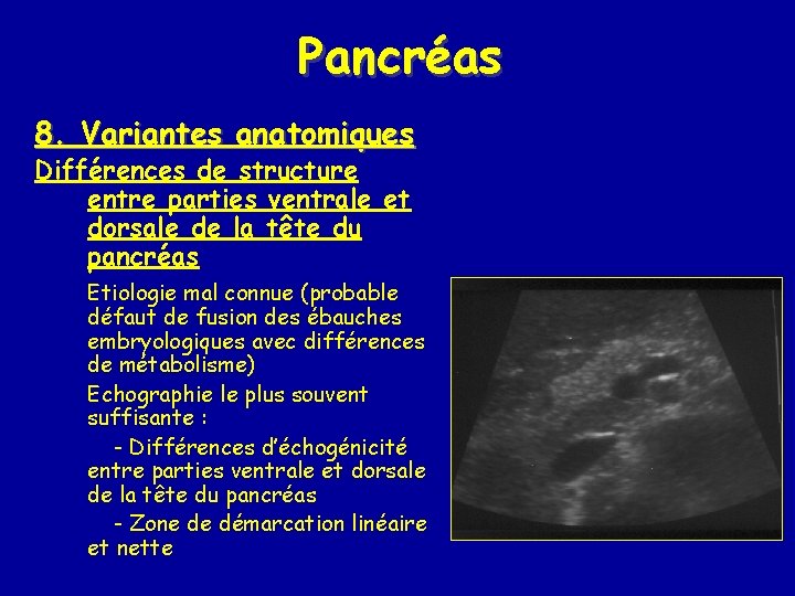 Pancréas 8. Variantes anatomiques Différences de structure entre parties ventrale et dorsale de la