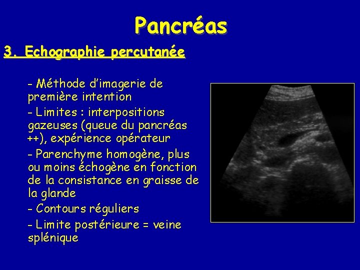 Pancréas 3. Echographie percutanée - Méthode d’imagerie de première intention - Limites : interpositions Pancréas 3. Echographie percutanée - Méthode d’imagerie de première intention - Limites : interpositions