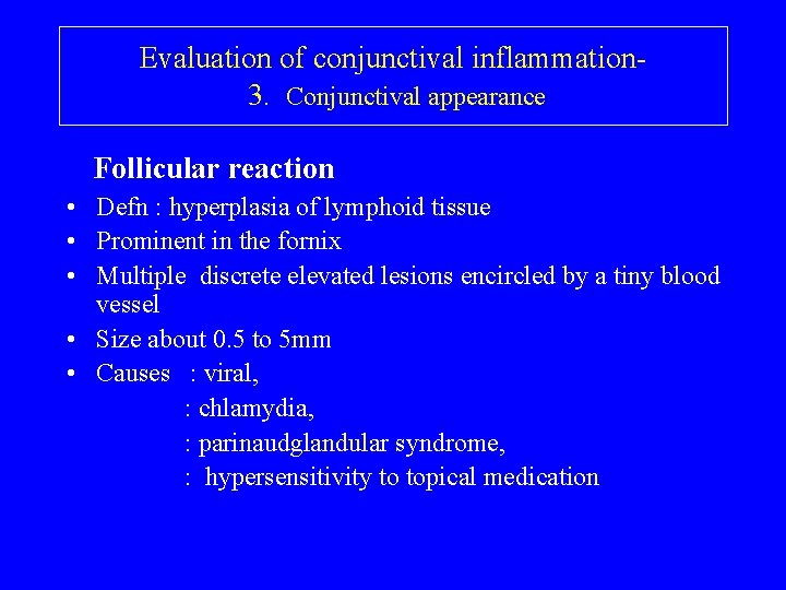 Evaluation of conjunctival inflammation 3. Conjunctival appearance Follicular reaction • Defn : hyperplasia of