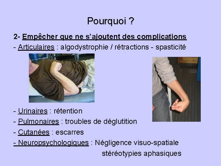 Pourquoi ? 2 - Empêcher que ne s’ajoutent des complications - Articulaires : algodystrophie