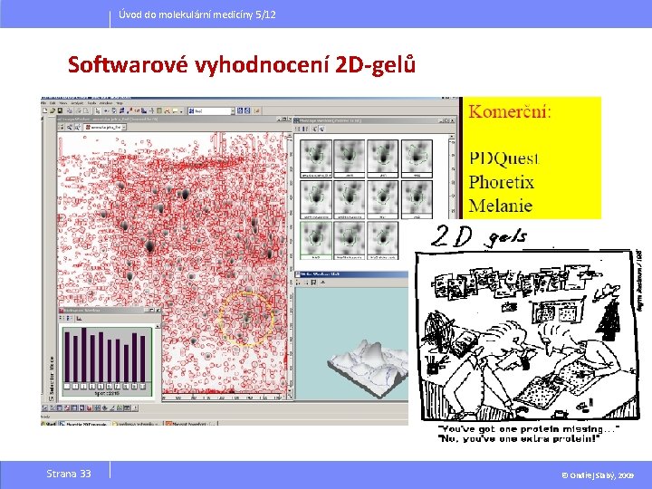 Úvod do molekulární medicíny 5/12 Softwarové vyhodnocení 2 D-gelů Strana 33 © Ondřej Slabý,