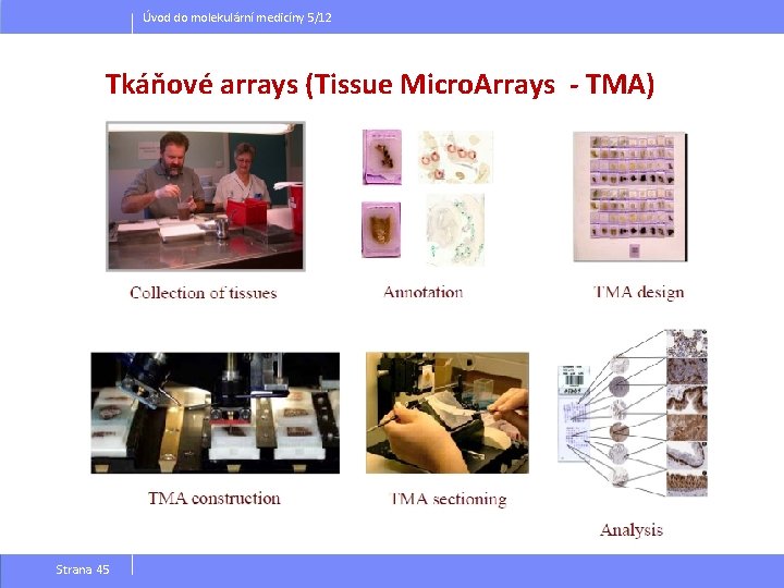 Úvod do molekulární medicíny 5/12 Tkáňové arrays (Tissue Micro. Arrays - TMA) Strana 45