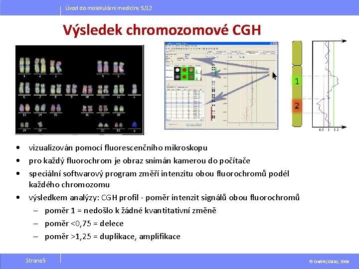 Úvod do molekulární medicíny 5/12 Výsledek chromozomové CGH • vizualizován pomocí fluorescenčního mikroskopu •