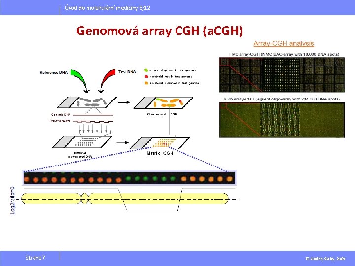 Úvod do molekulární medicíny 5/12 Genomová array CGH (a. CGH) Strana 7 © Ondřej