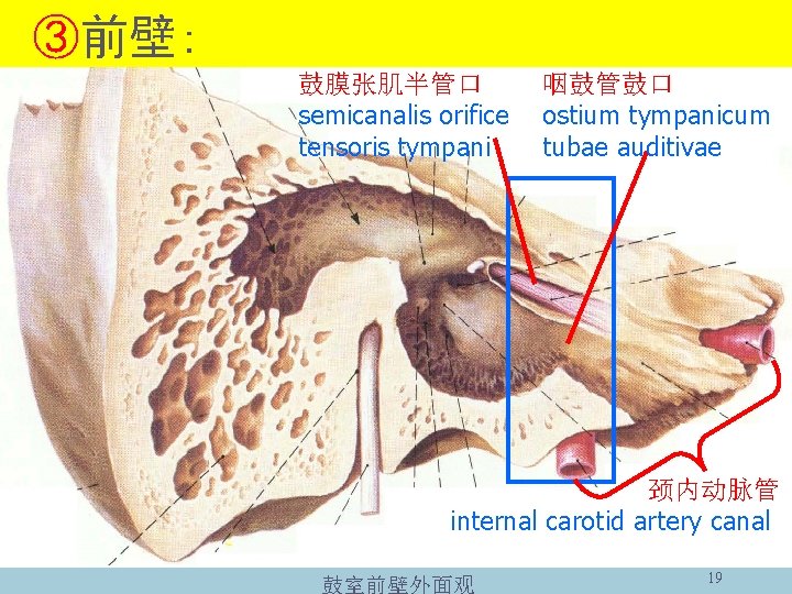 ③前壁: 鼓膜张肌半管口 semicanalis orifice tensoris tympani 咽鼓管鼓口 ostium tympanicum tubae auditivae 颈内动脉管 internal carotid