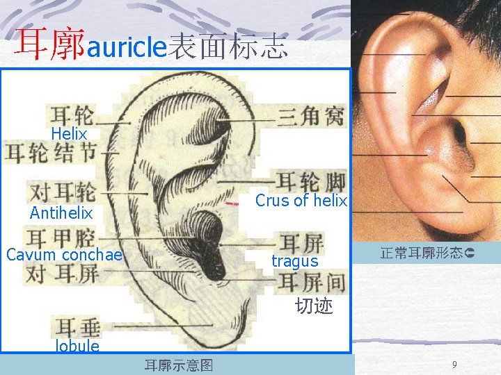 耳廓auricle表面标志 Helix Crus of helix Antihelix Cavum conchae tragus 正常耳廓形态 切迹 lobule 耳廓示意图 9