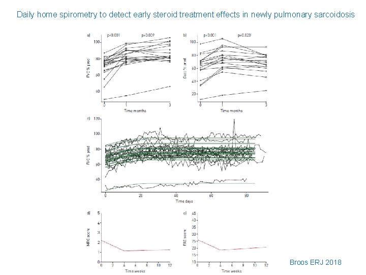 Daily home spirometry to detect early steroid treatment effects in newly pulmonary sarcoidosis Broos