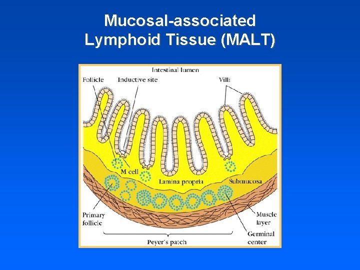 Mucosal-associated Lymphoid Tissue (MALT) 