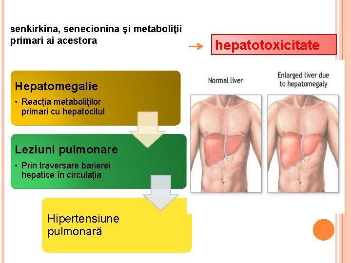 senkirkina, senecionina şi metaboliţii primari ai acestora Hepatomegalie • Reacţia metaboliţilor primari cu hepatocitul