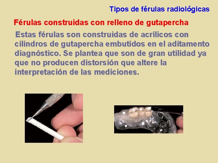 Tipos de férulas radiológicas Férulas construidas con relleno de gutapercha Estas férulas son construidas