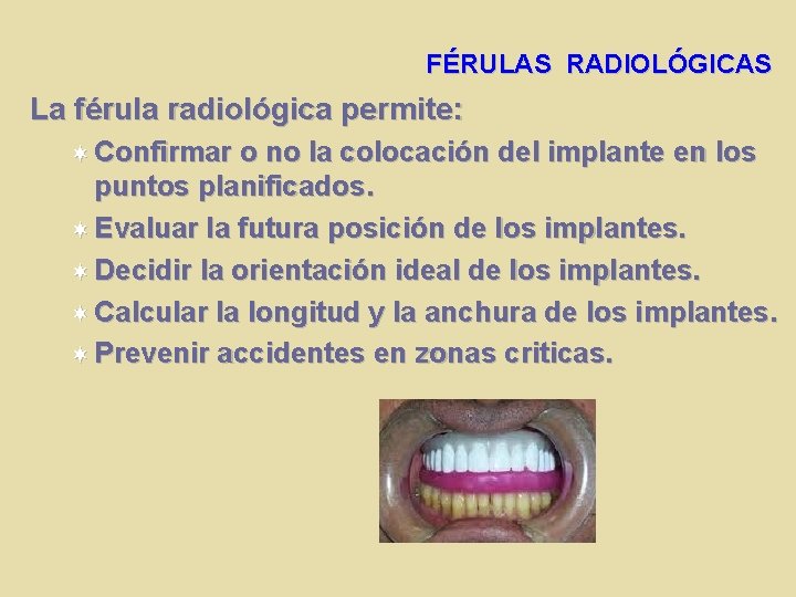 FÉRULAS RADIOLÓGICAS La férula radiológica permite: Confirmar o no la colocación del implante en