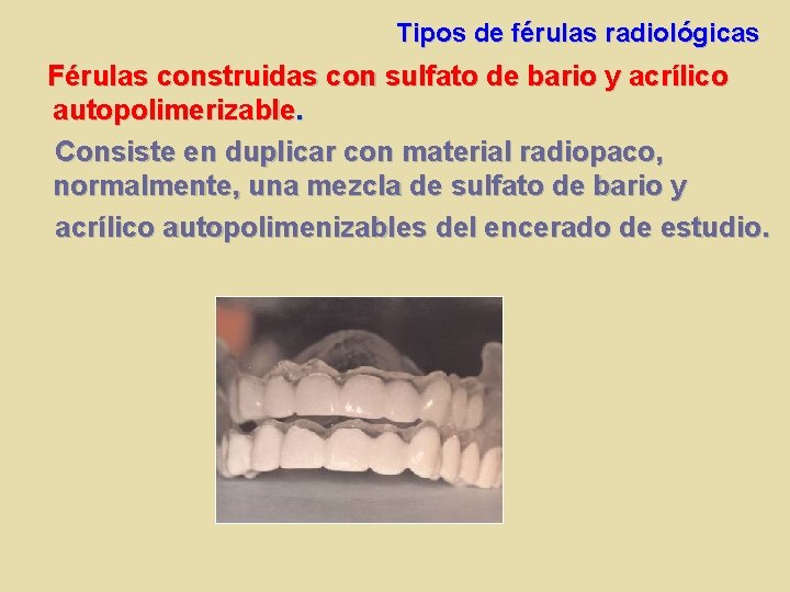 Tipos de férulas radiológicas Férulas construidas con sulfato de bario y acrílico autopolimerizable. Consiste